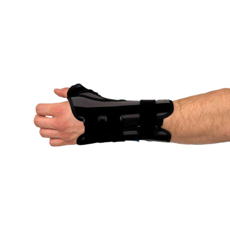 Csukló problémám van!