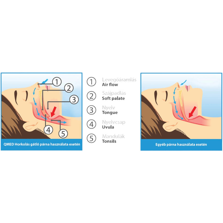 QMED Horkolásgátló Párna