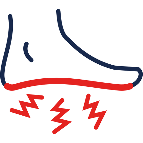 Talpi Bőnye Gyulladás - Plantar Fasciitis